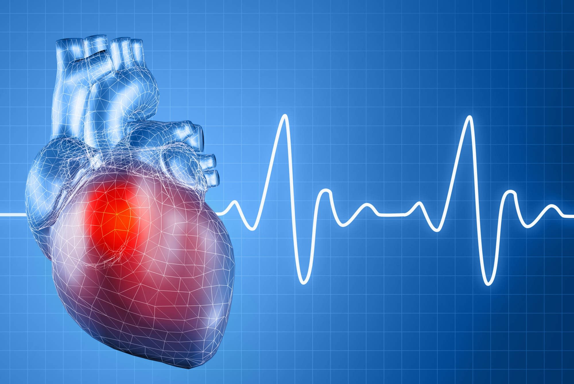 Intel·ligència artificial en cardiologia